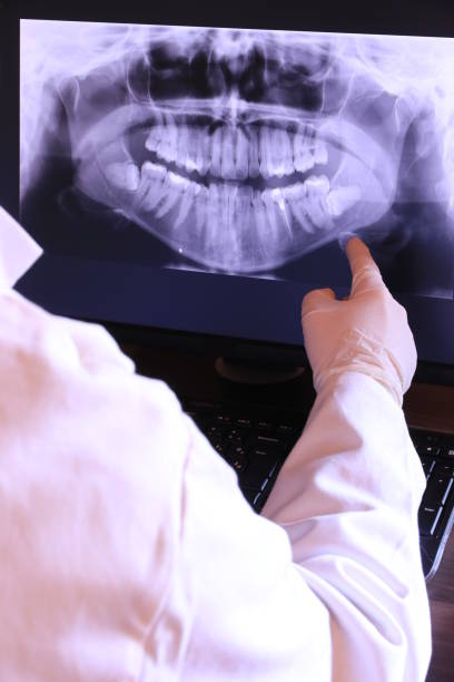 Best Urgent Care for Lost Fillings or Crowns in Concord, MI